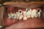 Worst Teeth Image