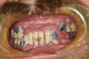 Worst Teeth Image